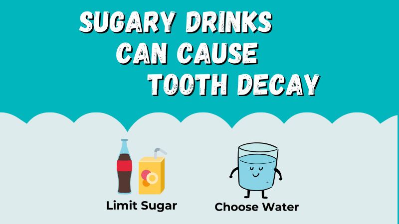 Sugary Drinks can Cause Tooth Decay